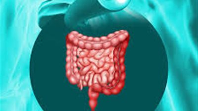 متلازمة القولون العصبي.. الأعراض والعلاج 