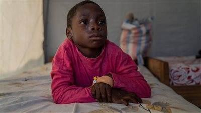 تفاصيل تفشي مرض جدري القرود وانتشار الفيروس القاتل