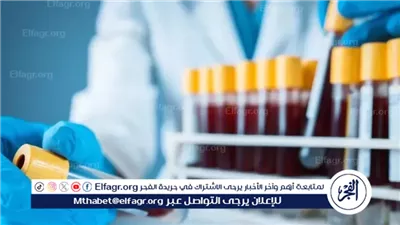 تحليل هرمون النمو.. طريقة الفحص والفئات المعرضة