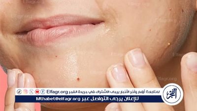 روتين العناية بالبشرة المختلطة في فصل الصيف