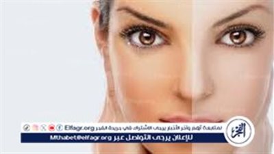 العسل والفراولة.. وصفات طبيعية لتفتيح البشرة