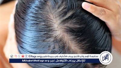 الشعر الدهني: أسبابه وأفضل الطرق للعناية به