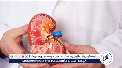 أمراض الكلى: الأنواع وطرق التشخيص والعلاج