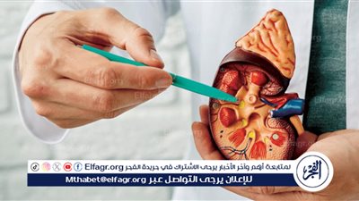 حصوات الكلى: التشخيص، العلاج، والوقاية
