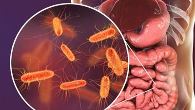 سبب إصابات أسوان.. ما هي بكتيريا الإيكولاي؟