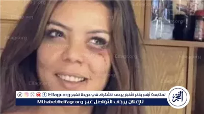 لهذا السبب.. ناهد السباعى تتعرض لكدمات وجروح بالغة الخطورة 