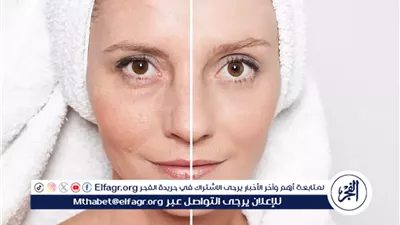 فوائد العسل للبشرة: التغذية والتجديد الطبيعي