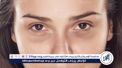 التخلص من الهالات السوداء تحت العين: الأسباب والحلول
