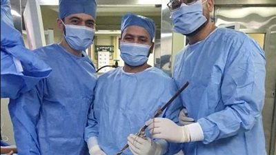 فريق طبي بقصر العيني ينقذ طفلًا من سيخ معدني في جراحة دقيقة