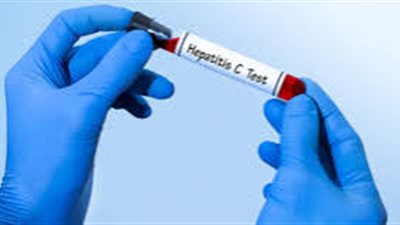 استشاري: الدولة وفرت أدوية بالمجان وبأسعار زهيدة لمواجهة فيروس سي