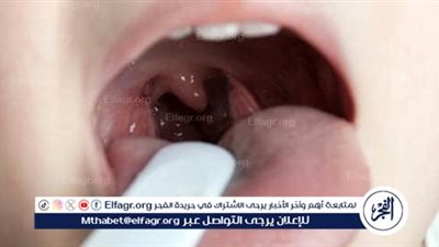 التهاب الحلق عند الأطفال: الأسباب والعلاج والوقاية