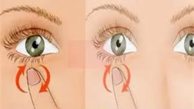 حساسية العين..تعرف على الأسباب والأعراض وطرق الوقاية والعلاج 