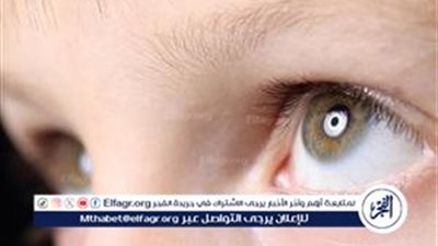 أمراض شبكية العين: الأسباب وطرق الوقاية للحفاظ على صحة البصر