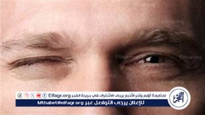 متلازمة العين الراقصة: الأسباب والأعراض والعلاج