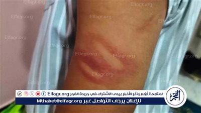 تعليم الغربية تفتح التحقيق في واقعة تعدي مدرس على طالب بالخرطوم