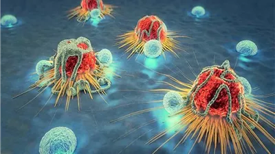 مرض السرطان: التحديات العالمية في محاربة أكبر قاتل 