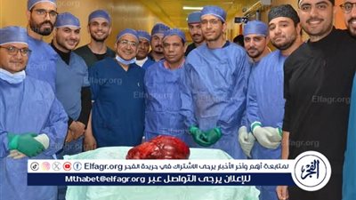 فريق طبي بجامعة أسيوط ينجح في استئصال ورم ضخم خلف الغشاء البريتوني للبطن لسيدة أربعينية