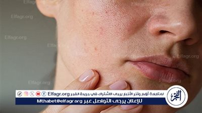 العناية بالبشرة والشعر في فصل الشتاء