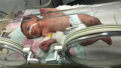 الفجر تحاور طبيب طفلة المنور ويكشف تفاصيل الحادث