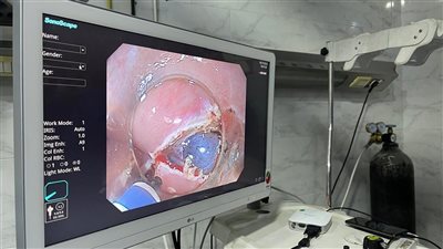 «الصحة» تعلن نجاح مستشفى منيا القمح في إجراء تدخلات متطورة بتقنية الفراغ الثالث