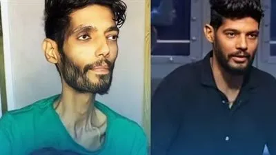 عاجل- حالته حرجة جدًا: كل ما تريد معرفته عن حالة إبراهيم شيكا لاعب الزمالك السابق