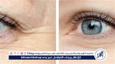 وداعًا للبقع والتجاعيد!.. ماسك سحري لتفتيح البشرة بمكونات طبيعية 100%