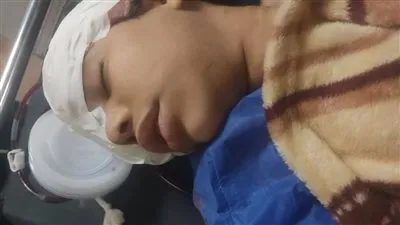 إصابة طفلة ووالدها بإصابات بالغة بالمنوفية