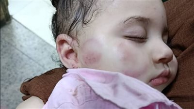 أم تستغيث بعد تعرض طفلتها لاعتداء داخل حضانة خاصة