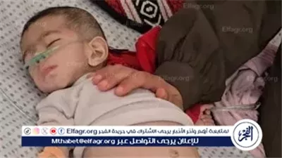 عاجل:- وفاة طفلة في غزة بسبب المجاعة والجفاف وارتفاع عدد ضحايا سوء التغذية إلى 54 طفلًا