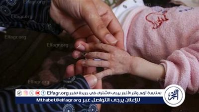 الطفلة ملك تثير القلق الطبي والإنساني.. دماغ مفقود وسط واقع حرب الإبادة في غزة