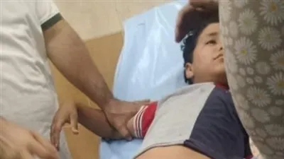 إصابة طفل إثر سقوط من علو على جذع شجرة بقرية المشرك بالفيوم