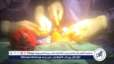 وكيل صحة الدقهلية يؤكد: نجاح أول جراحة للمخ والأعصاب بمستشفى بلقاس 