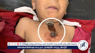 فريق طبي ينجح في إنقاذ طفل بمعجزة لتعرضه لضربة بآلة حادة بالصدر 