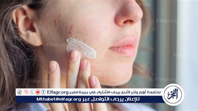 البشرة الدهنية الحساسة تحت أشعة الشمس.. رحلة بين المعاناة والمواجهة