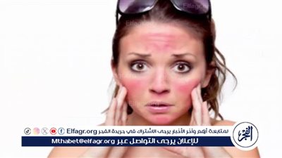 أضرار أشعة الشمس على البشرة بين التوعية والإهمال