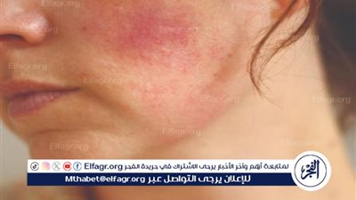 أشعة الشمس تُفشل روتينك التجميلي.. كيف تحافظين على نضارة بشرتك في الصيف؟