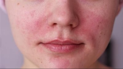 هل نوافذ زجاج السيارة تحمي بشرتك من أشعة الشمس؟