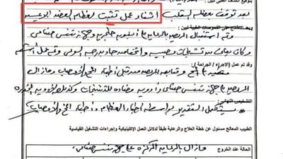 فرع الرعاية الصحية ببورسعيد يفتح تحقيقًا في تعرض شاب لمضاعفات خلال عملية جراحية