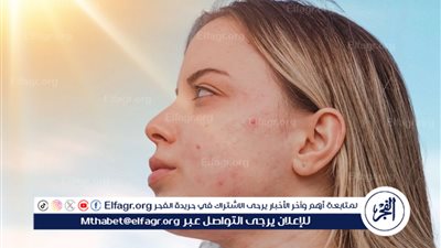 واقي الشمس.. درعك الواقي من مخاطر الصيف