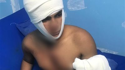 طالب يعتدي على صديقه بسلاح أبيض في شبرا الخيمة بسبب خلاف على هاتف