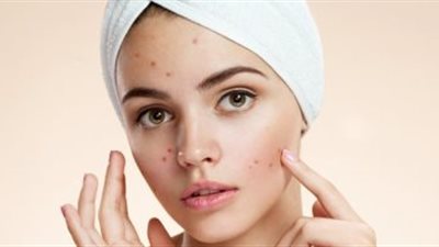 بشرتك في الشتاء.. كيف تحميها من الجفاف والتشقق؟