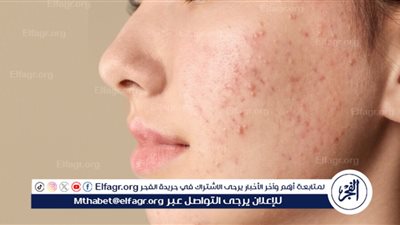 البشرة.. مرآة الصحة وأسرار الحفاظ على إشراقتها