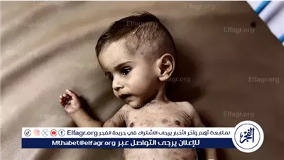 وزنه لا يتجاوز 3 كيلو.. مأساة الرضيع علي أبو عاذرة تجسد أزمة المجاعة وسوء التغذية في غزة