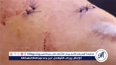 تفاصيل اعتداء 5 أشخاص علي طالب ثانويه في الدقهلية 