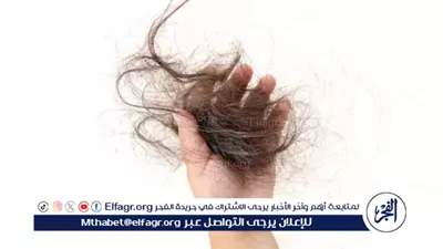 تساقط الشعر.. أزمة جمالية تواجه النساء والرجال وهذه أفضل طرق التعامل معها 