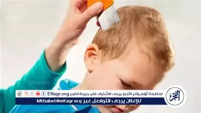 5 طرق ذكية لحماية الأطفال من قمل الرأس.. الفحص الدوري والنظافة هما الحل