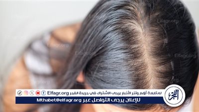 تساقط الشعر بعد الولادة.. معاناة مؤقتة تواجهها الأمهات ويمكن التغلب عليها بسهولة