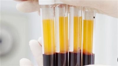مخالفات تداول بلازما الدم.. عقوبات وغرامات تصل لمليون جنيه