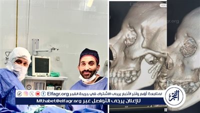 نجاح عمليتين دقيقتين لجراحة الوجه والفكين بمستشفى شربين المركزي في الدقهلية