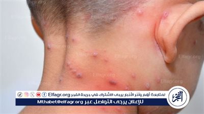 أول تعليق رسمي من تعليم المنوفية بشأن ظهور حالات 